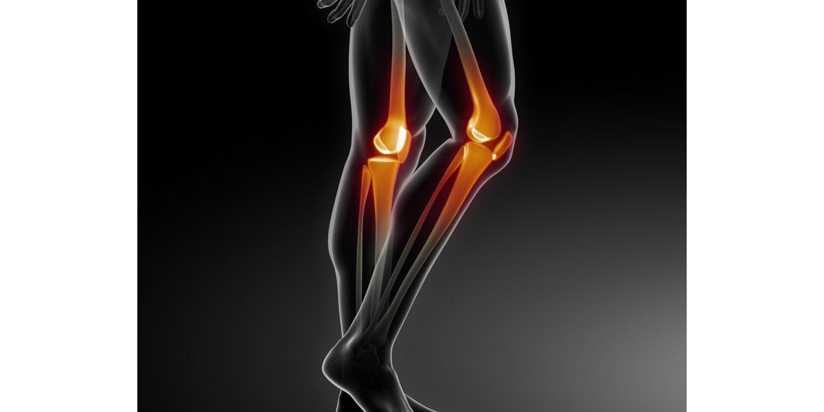 膝关节病专业